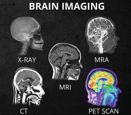 What's the Difference Between a PET Scan and a CT Scan? And Why Do Bananas Glow Under a PET Scanner?